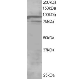 Western Blot - Anti-ORP11 Antibody (A83980) - Antibodies.com