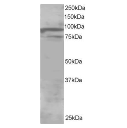 Western Blot - Anti-ORP11 Antibody (A83980) - Antibodies.com