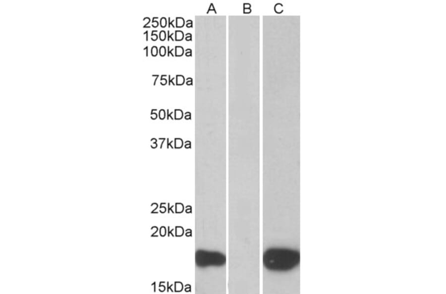 Western Blot - Anti-PHLDA3 Antibody (A83982) - Antibodies.com