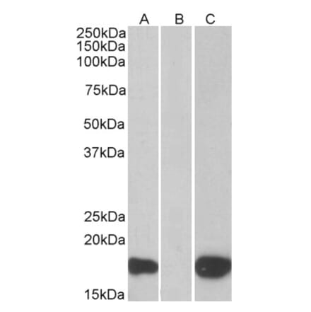 Western Blot - Anti-PHLDA3 Antibody (A83982) - Antibodies.com