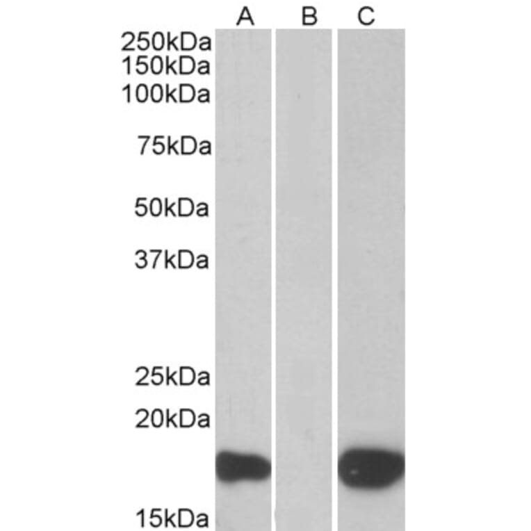 Western Blot - Anti-PHLDA3 Antibody (A83982) - Antibodies.com