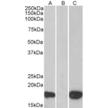 Western Blot - Anti-PHLDA3 Antibody (A83982) - Antibodies.com
