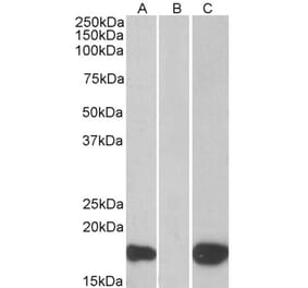Western Blot - Anti-PHLDA3 Antibody (A83982) - Antibodies.com
