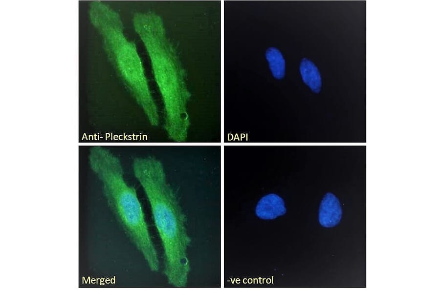 Immunofluorescence - Anti-Pleckstrin Antibody (A83983) - Antibodies.com
