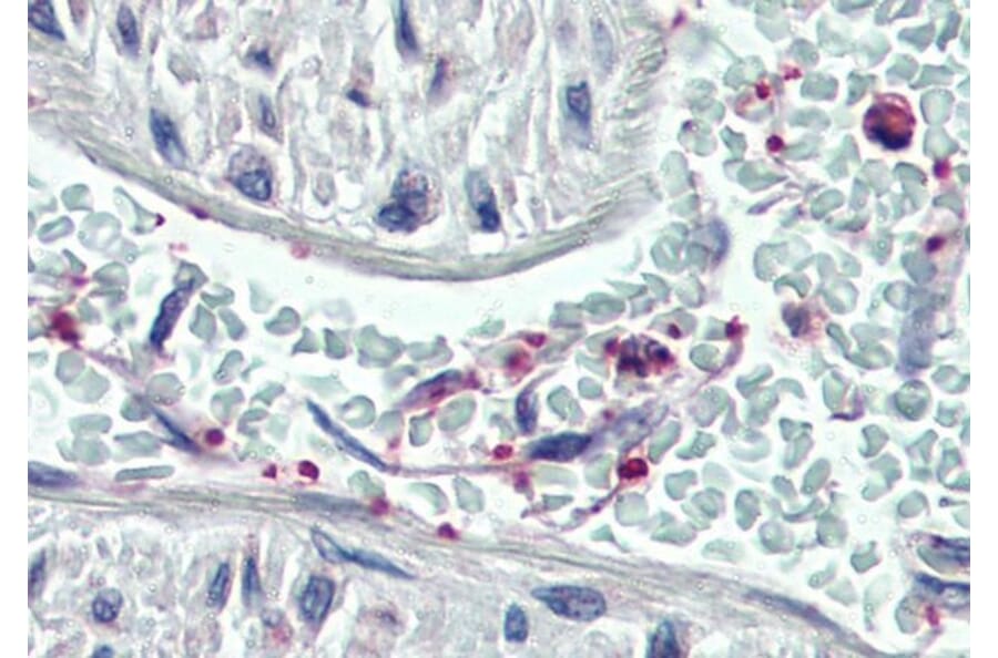 Immunohistochemistry - Anti-Pleckstrin Antibody (A83983) - Antibodies.com