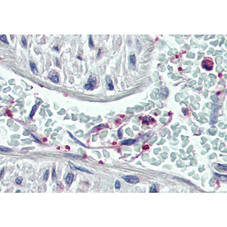 Immunohistochemistry - Anti-Pleckstrin Antibody (A83983) - Antibodies.com