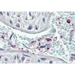 Immunohistochemistry - Anti-Pleckstrin Antibody (A83983) - Antibodies.com