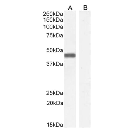 Western Blot - Anti-PLEK Antibody (A83983)