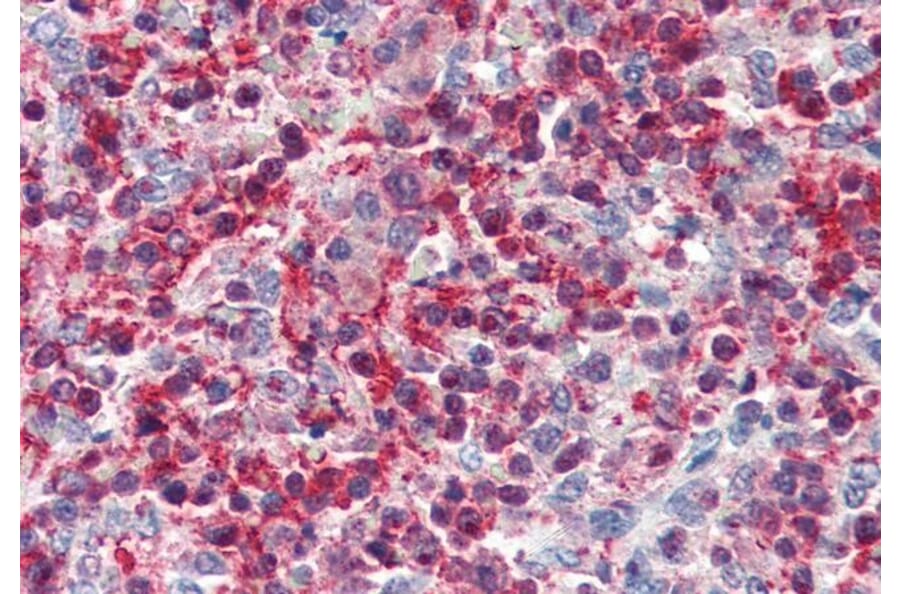 Immunohistochemistry - Anti-Pleckstrin Antibody (A83983) - Antibodies.com
