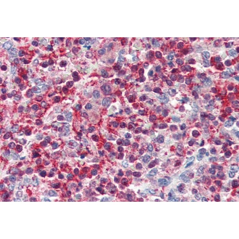 Immunohistochemistry - Anti-Pleckstrin Antibody (A83983) - Antibodies.com