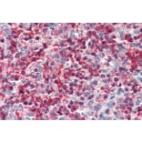 Immunohistochemistry - Anti-Pleckstrin Antibody (A83983) - Antibodies.com