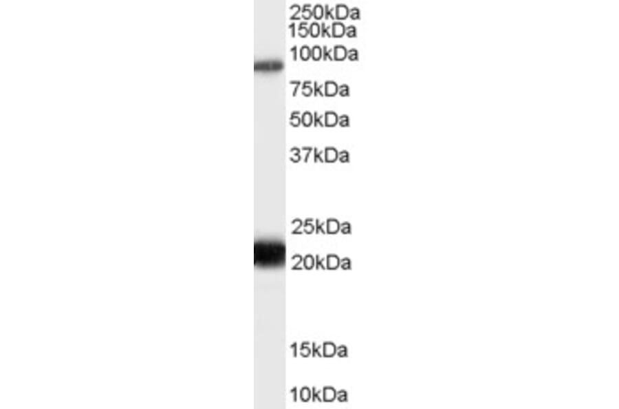 Western Blot - Anti-RASAL1 Antibody (A83984) - Antibodies.com