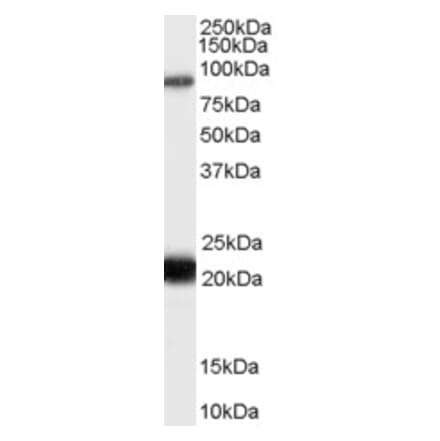 Western Blot - Anti-RASAL1 Antibody (A83984) - Antibodies.com