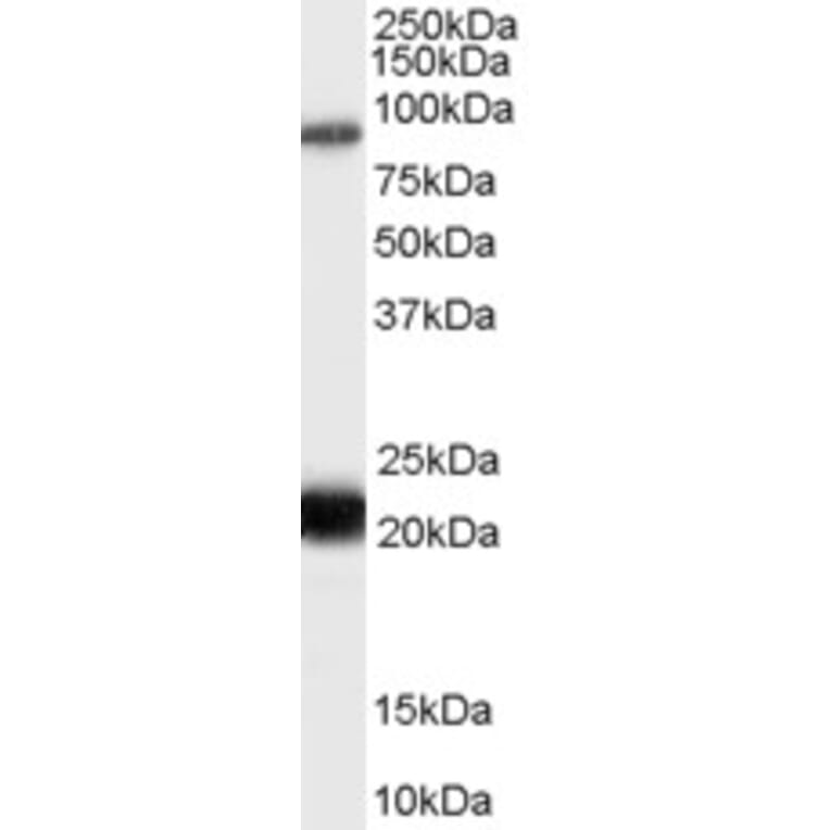 Western Blot - Anti-RASAL1 Antibody (A83984) - Antibodies.com