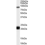 Western Blot - Anti-RASAL1 Antibody (A83984) - Antibodies.com