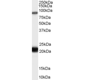 Western Blot - Anti-RASAL1 Antibody (A83984) - Antibodies.com