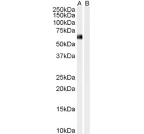 Western Blot - Anti-Syntrophin alpha 1 Antibody (A83985) - Antibodies.com