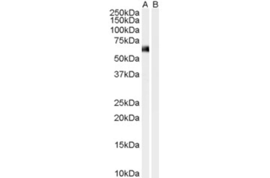 Western Blot - Anti-Syntrophin alpha 1 Antibody (A83985) - Antibodies.com