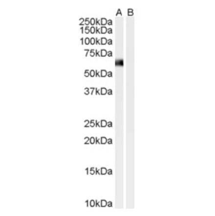 Western Blot - Anti-Syntrophin alpha 1 Antibody (A83985) - Antibodies.com