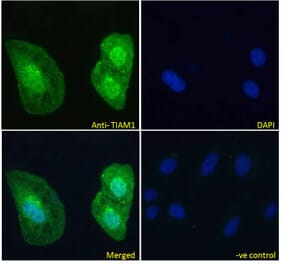 Immunofluorescence - Anti-TIAM1 Antibody (A83986) - Antibodies.com