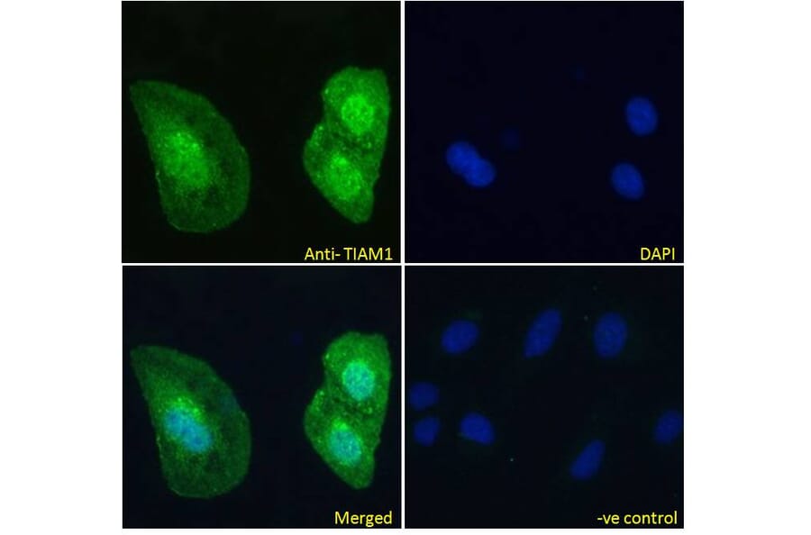 Immunofluorescence - Anti-TIAM1 Antibody (A83986) - Antibodies.com