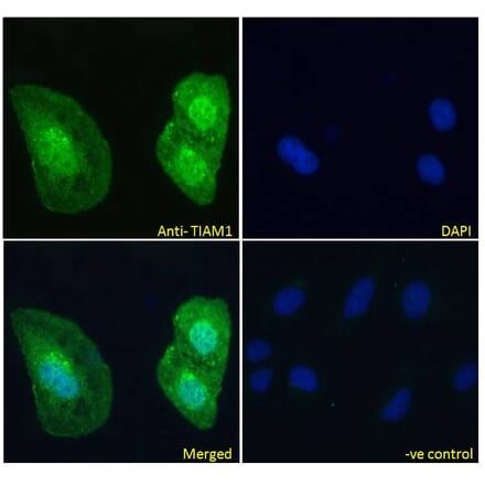 Immunofluorescence - Anti-TIAM1 Antibody (A83986) - Antibodies.com