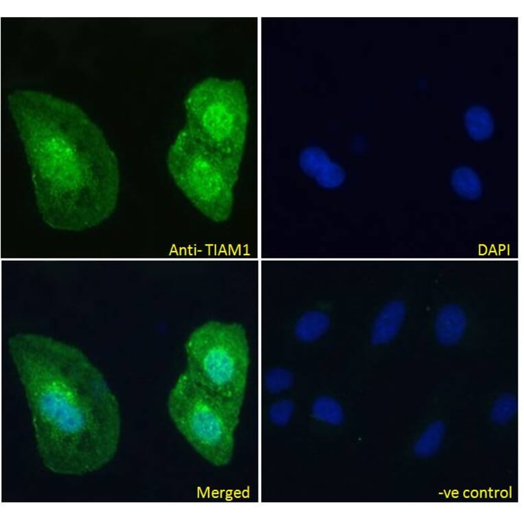 Immunofluorescence - Anti-TIAM1 Antibody (A83986) - Antibodies.com