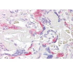 Immunohistochemistry - Anti-TSSC3 Antibody (A83987) - Antibodies.com
