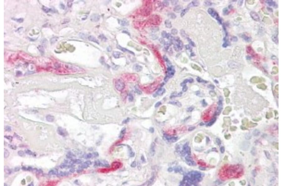 Immunohistochemistry - Anti-TSSC3 Antibody (A83987) - Antibodies.com