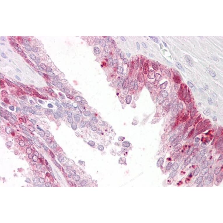 Immunohistochemistry - Anti-TSSC3 Antibody (A83987) - Antibodies.com
