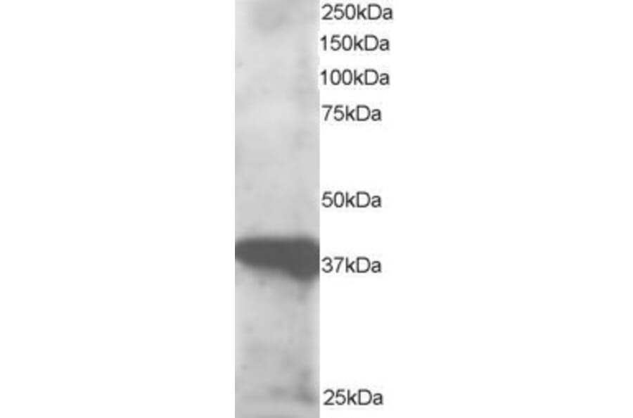 Western Blot - Anti-GIPC3 Antibody (A83989) - Antibodies.com