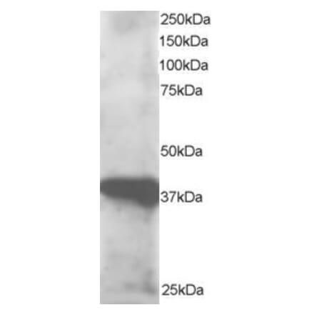 Western Blot - Anti-GIPC3 Antibody (A83989) - Antibodies.com