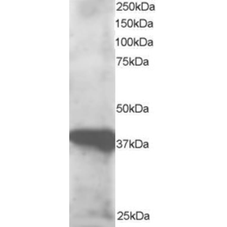 Western Blot - Anti-GIPC3 Antibody (A83989) - Antibodies.com