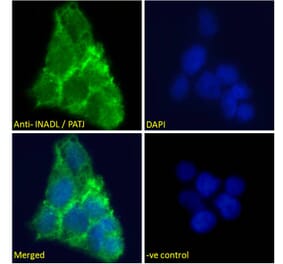 Immunofluorescence - Anti-PATJ Antibody (A83990) - Antibodies.com