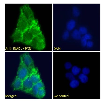 Immunofluorescence - Anti-PATJ Antibody (A83990) - Antibodies.com