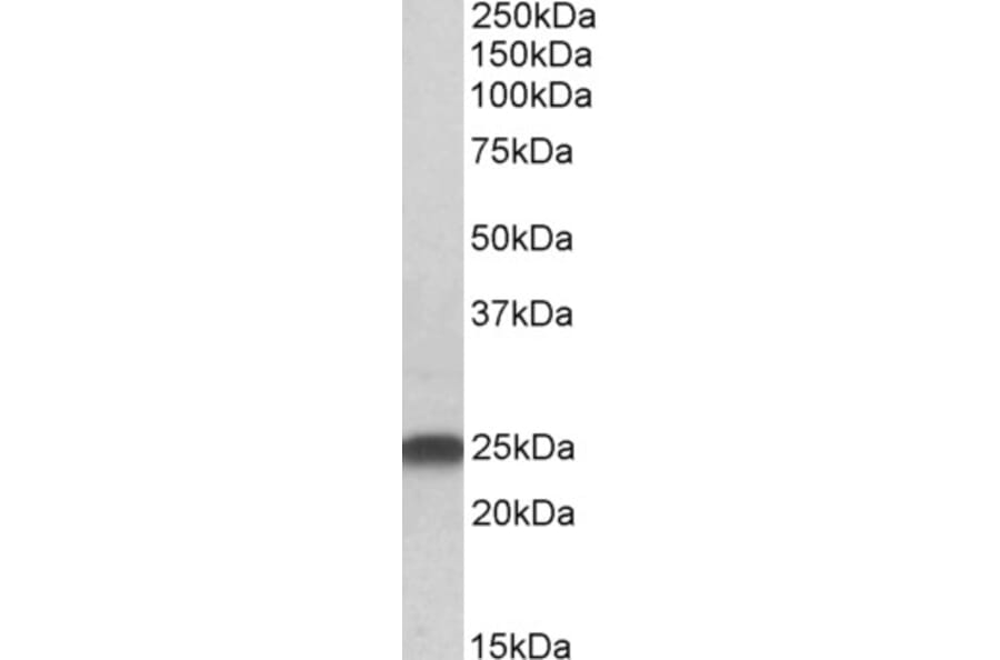 Western Blot - Anti-LIN7B Antibody (A83991) - Antibodies.com