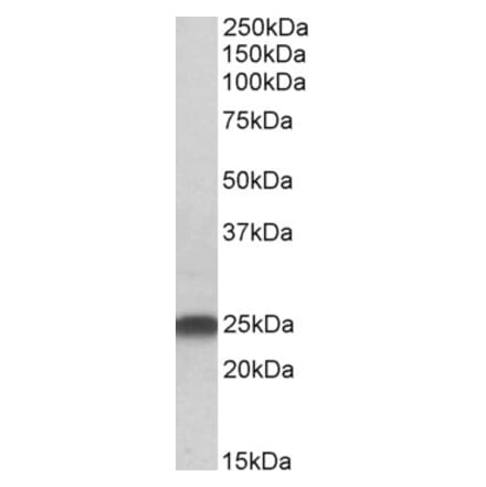 Western Blot - Anti-LIN7B Antibody (A83991) - Antibodies.com