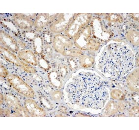 Immunohistochemistry - Anti-SNX8 Antibody (A83992) - Antibodies.com