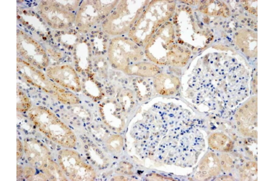 Immunohistochemistry - Anti-SNX8 Antibody (A83992) - Antibodies.com