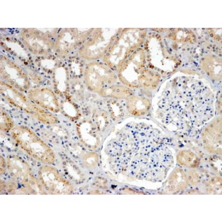 Immunohistochemistry - Anti-SNX8 Antibody (A83992) - Antibodies.com