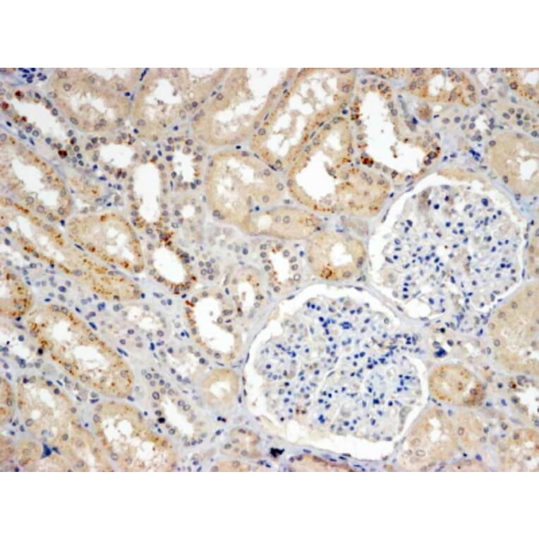 Immunohistochemistry - Anti-SNX8 Antibody (A83992) - Antibodies.com