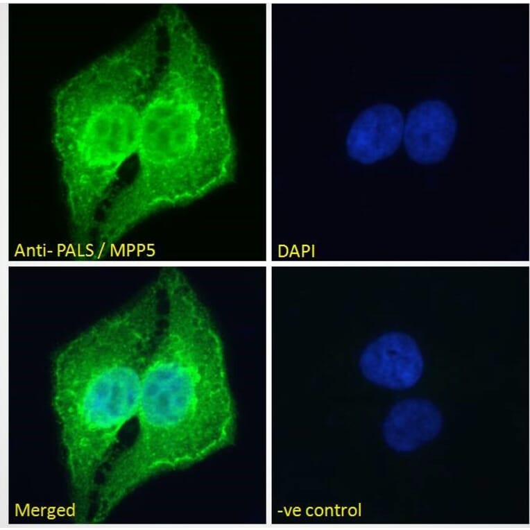 Immunofluorescence - Anti-MPP5/Pals1 Antibody (A83993) - Antibodies.com