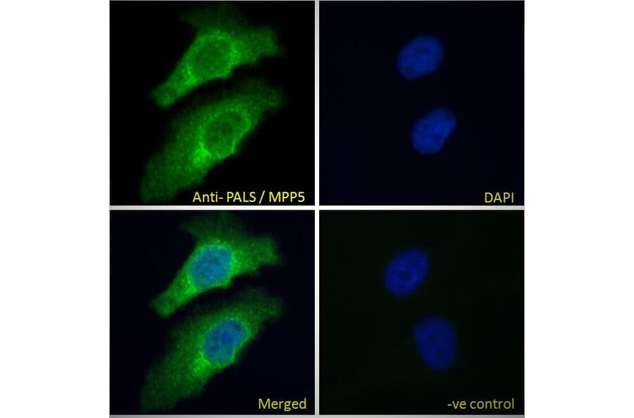 Immunofluorescence - Anti-MPP5/Pals1 Antibody (A83993) - Antibodies.com