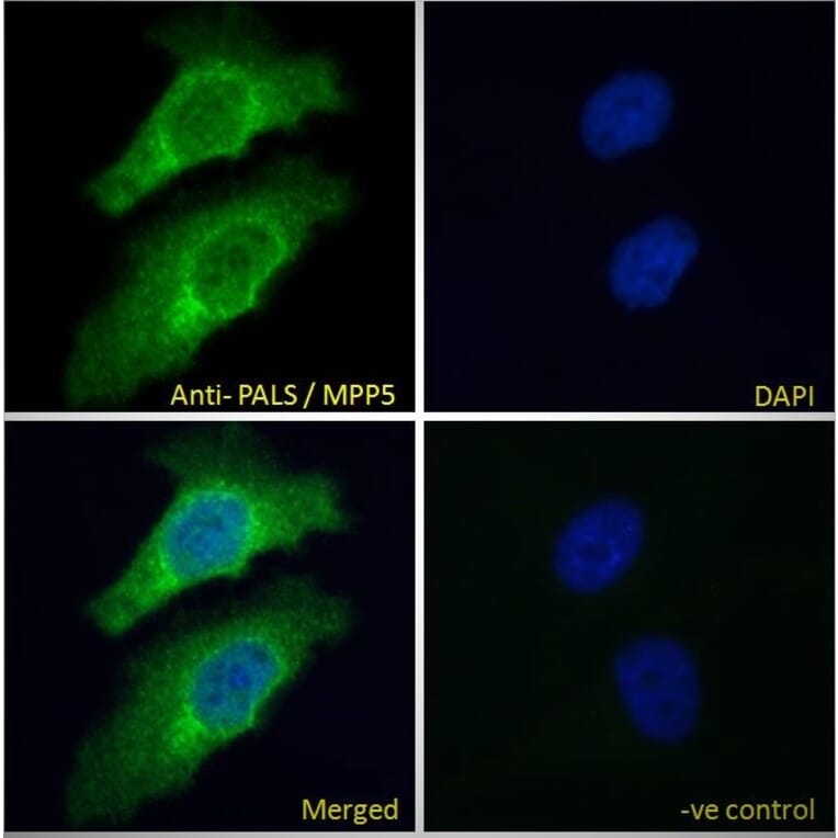 Immunofluorescence - Anti-MPP5/Pals1 Antibody (A83993) - Antibodies.com