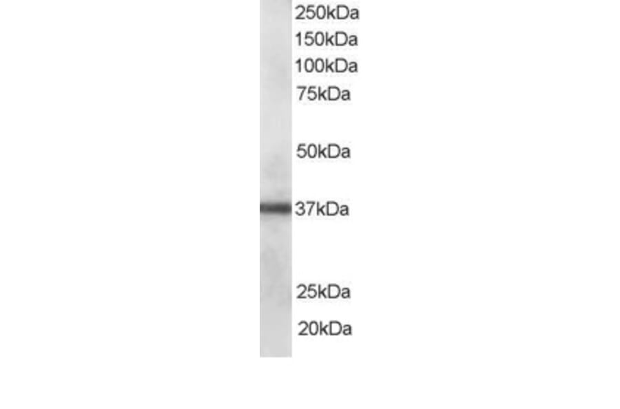 Western Blot - Anti-PDLIM1/CLP36 Antibody (A83995) - Antibodies.com