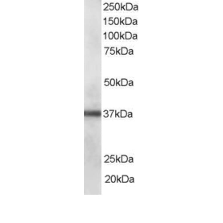 Western Blot - Anti-PDLIM1/CLP36 Antibody (A83995) - Antibodies.com