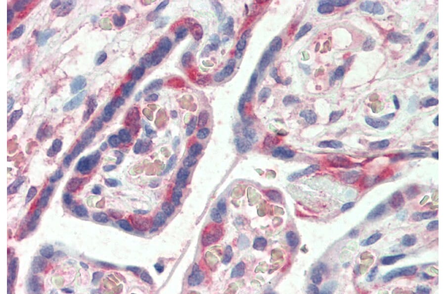 Immunohistochemistry - Anti-PDLIM1/CLP36 Antibody (A83995) - Antibodies.com
