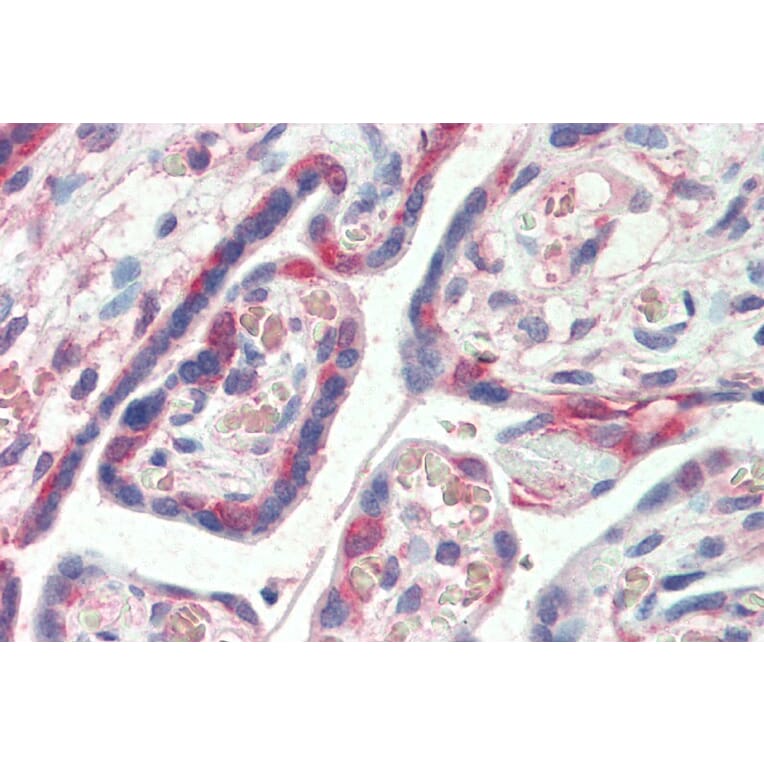 Immunohistochemistry - Anti-PDLIM1/CLP36 Antibody (A83995) - Antibodies.com