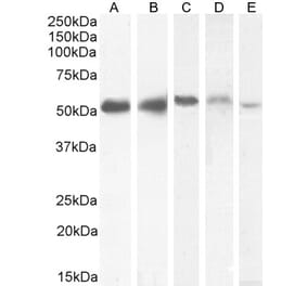 Western Blot - Anti-KPNA2 Antibody (A83997) - Antibodies.com