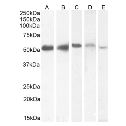 Western Blot - Anti-KPNA2 Antibody (A83997) - Antibodies.com